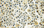 Integrin beta-7 Antibody in Immunohistochemistry (Paraffin) (IHC (P))