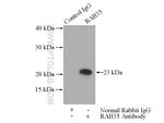 RAB35 Antibody in Immunoprecipitation (IP)