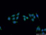 XPG Antibody in Immunocytochemistry (ICC/IF)