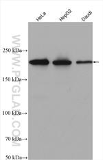 XPG Antibody in Western Blot (WB)