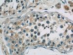 EIF2B4 Antibody in Immunohistochemistry (Paraffin) (IHC (P))