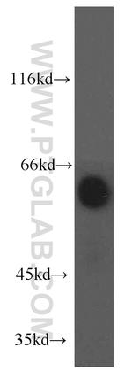 EIF2B4 Antibody in Western Blot (WB)