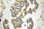 EIF2B4 Antibody in Immunohistochemistry (Paraffin) (IHC (P))