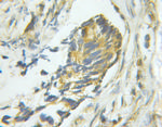 PTP1B Antibody in Immunohistochemistry (Paraffin) (IHC (P))