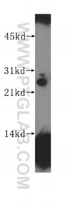 HOP2 Antibody in Western Blot (WB)