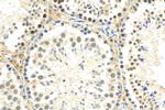 HOP2 Antibody in Immunohistochemistry (Paraffin) (IHC (P))