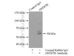 ZBTB7B Antibody in Immunoprecipitation (IP)