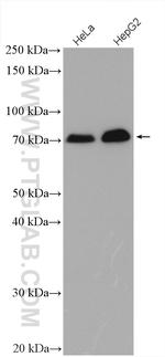 ZBTB7B Antibody in Western Blot (WB)