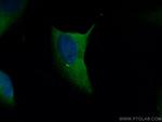 FGFR1OP Antibody in Immunocytochemistry (ICC/IF)