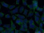 FGFR1OP Antibody in Immunocytochemistry (ICC/IF)