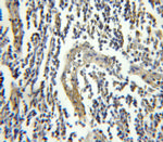 FGFR1OP Antibody in Immunohistochemistry (Paraffin) (IHC (P))