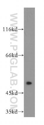 FGFR1OP Antibody in Western Blot (WB)