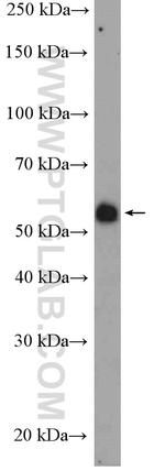 FGFR1OP Antibody in Western Blot (WB)