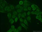 HDGF Antibody in Immunocytochemistry (ICC/IF)