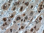 HDGF Antibody in Immunohistochemistry (Paraffin) (IHC (P))