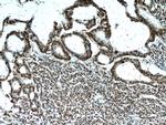 HDGF Antibody in Immunohistochemistry (Paraffin) (IHC (P))