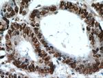 HDGF Antibody in Immunohistochemistry (Paraffin) (IHC (P))