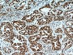 HDGF Antibody in Immunohistochemistry (Paraffin) (IHC (P))