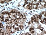 HDGF Antibody in Immunohistochemistry (Paraffin) (IHC (P))