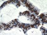 HDGF Antibody in Immunohistochemistry (Paraffin) (IHC (P))