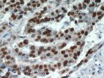 HDGF Antibody in Immunohistochemistry (Paraffin) (IHC (P))