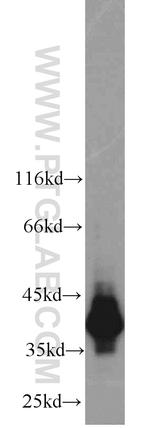 HDGF Antibody in Western Blot (WB)