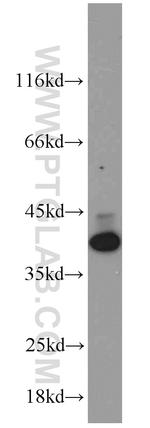 HDGF Antibody in Western Blot (WB)