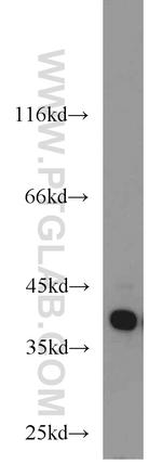 HDGF Antibody in Western Blot (WB)