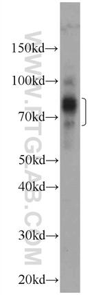 NSD3 Antibody in Western Blot (WB)