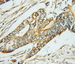 ABAT Antibody in Immunohistochemistry (Paraffin) (IHC (P))