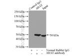 ABAT Antibody in Immunoprecipitation (IP)