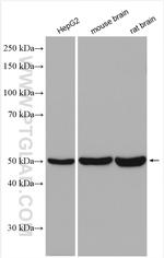 ABAT Antibody in Western Blot (WB)