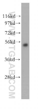 ABAT Antibody in Western Blot (WB)