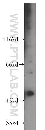 EIF3E Antibody in Western Blot (WB)