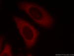 EIF3E Antibody in Immunocytochemistry (ICC/IF)