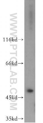 EIF3E Antibody in Western Blot (WB)