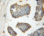 LGP2 Antibody in Immunohistochemistry (Paraffin) (IHC (P))