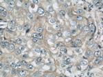 LGP2 Antibody in Immunohistochemistry (Paraffin) (IHC (P))