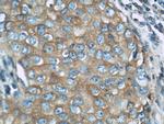 LGP2 Antibody in Immunohistochemistry (Paraffin) (IHC (P))