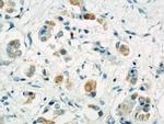 LGP2 Antibody in Immunohistochemistry (Paraffin) (IHC (P))