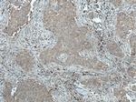 LGP2 Antibody in Immunohistochemistry (Paraffin) (IHC (P))