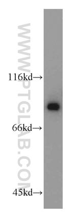 DDX1 Antibody in Western Blot (WB)