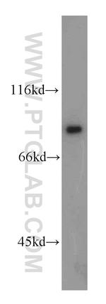 DDX1 Antibody in Western Blot (WB)