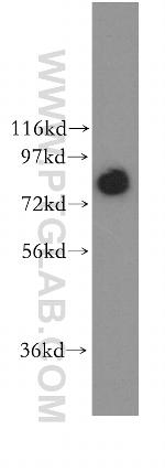 DDX1 Antibody in Western Blot (WB)