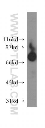 Harmonin Antibody in Western Blot (WB)