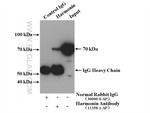 Harmonin Antibody in Immunoprecipitation (IP)