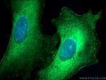 ARHGEF1 Antibody in Immunocytochemistry (ICC/IF)