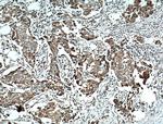 NCKIPSD Antibody in Immunohistochemistry (Paraffin) (IHC (P))