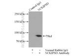 NCKIPSD Antibody in Immunoprecipitation (IP)