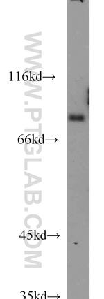 NCKIPSD Antibody in Western Blot (WB)